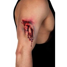 Morsure de zombie